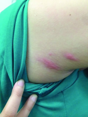 �����ϱ�����ҧ��ͼƬ��ȫ Ԥ���������֪ʶ