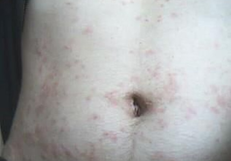 �����ϱ�����ҧ��ͼƬ��ȫ Ԥ���������֪ʶ