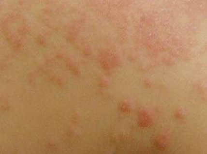 �����ϱ�����ҧ��ͼƬ��ȫ Ԥ���������֪ʶ