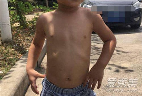 С�����ظ�ʲô�� С�����غ�����������ͼƬ