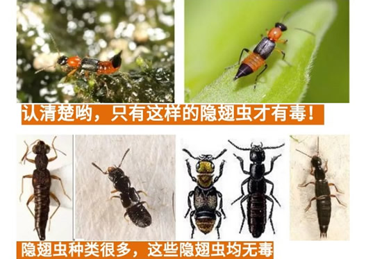 隐翅虫是什么虫毒性大吗 隐翅虫咬人后症状早期
