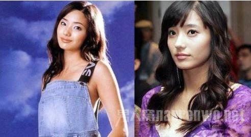 韩彩英整容前后对比照 平胸变巨乳变双眼皮
