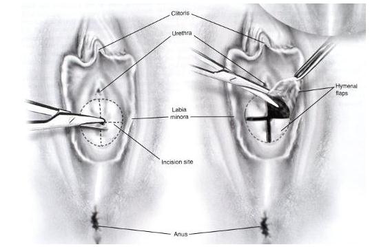 ʯŮ����˼��ʲô��˼ ������ʯŮ��ʲô����