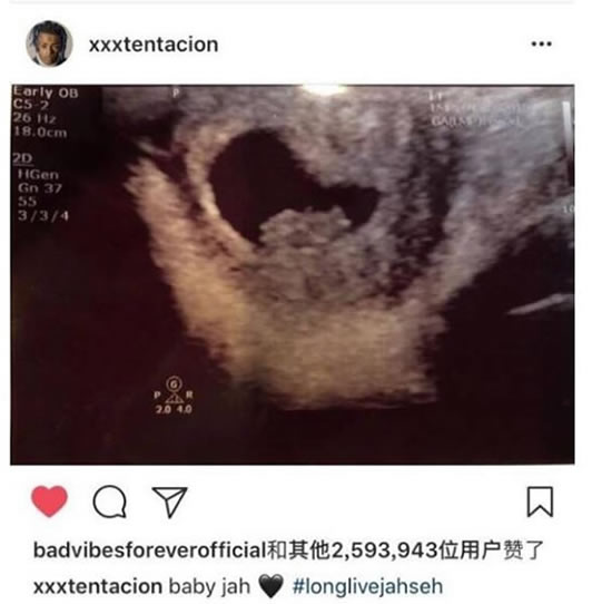 XXXtentacion������Ƭ ���ں�̺�����