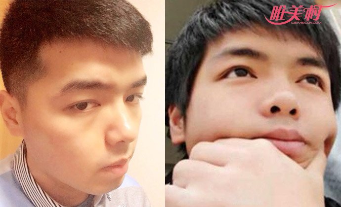 ������������������Ƭ LOLֱ������Ϊʲô��ô��