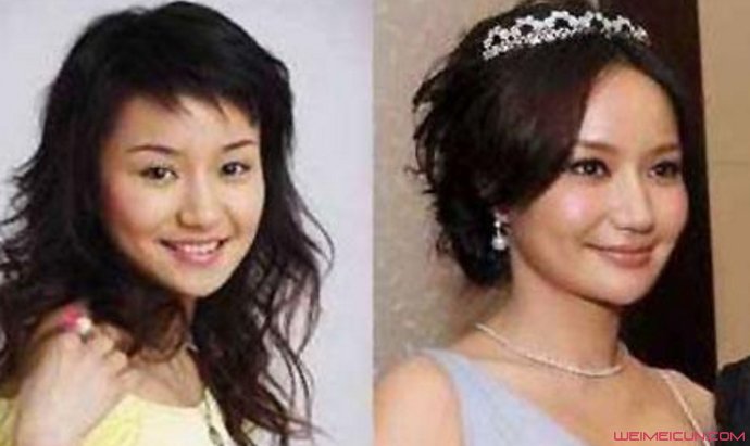 韩雨芹整容前后对比 难道她也整容了吗?