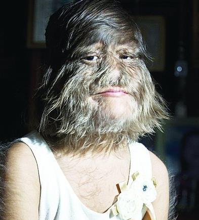 ����ʮ���޺�ͼƬ �޺���������ʲô