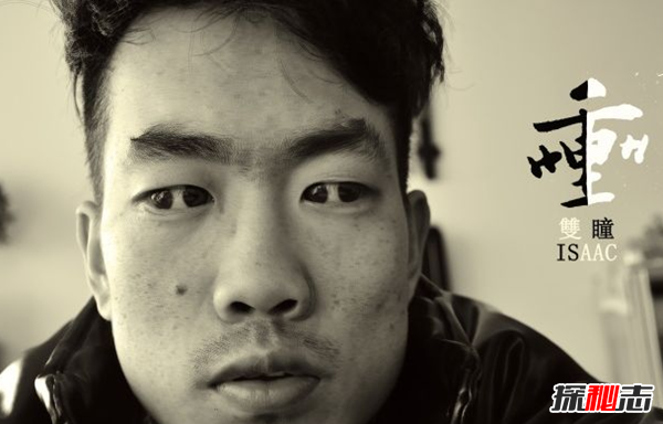 历史上双目四瞳的人是谁