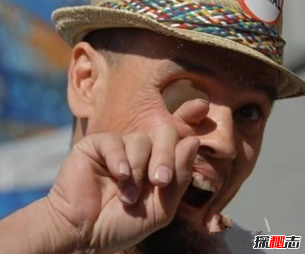 历史上双目四瞳的人是谁