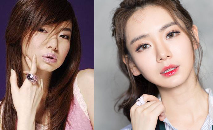 ��ޱ����ǰ����Ƭ�Ա� ��ޱ���ϸ�˫��Ƥ