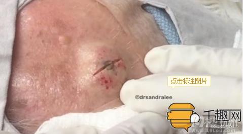 ���������ĺ�ͷ������ ���ܵ����ֱ���