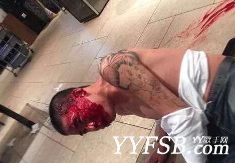 刘一手被打满脸血 IR刘一手被打现场图片