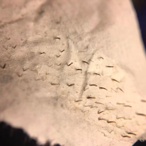 密集恐惧症芝麻女恶心 密集恐惧症芝麻女孩原图