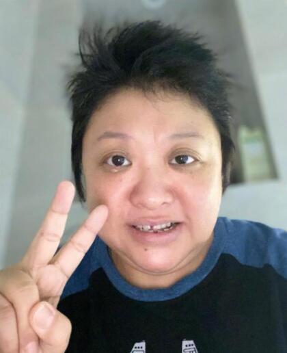 韩红得的是什么病?韩红的身体状况怎么样
