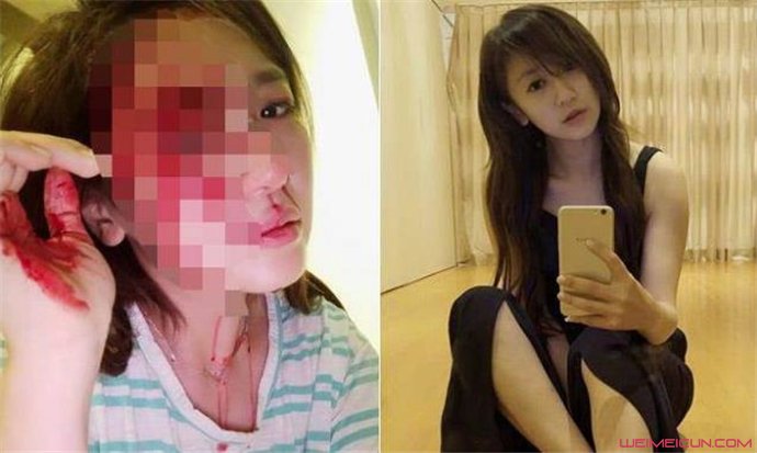 蔡小洁玩手机被砸破头 蔡小洁性感照
