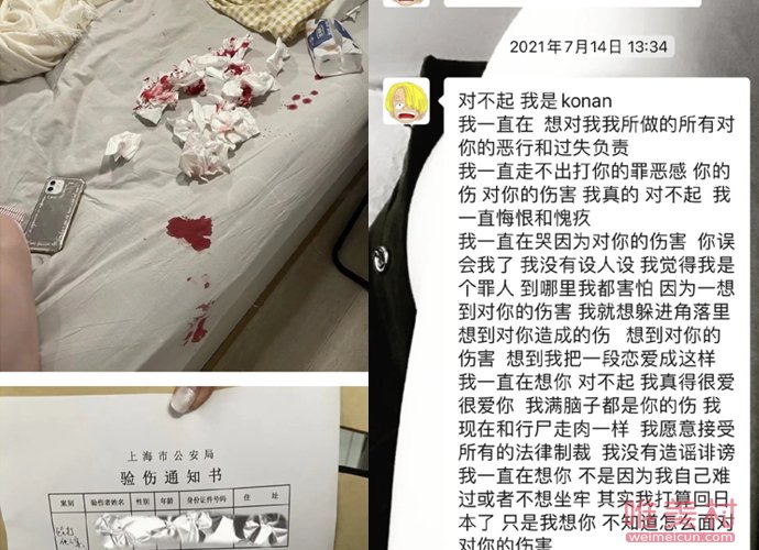 非正式会谈7金子浩拓家暴 被指是一个软饭男