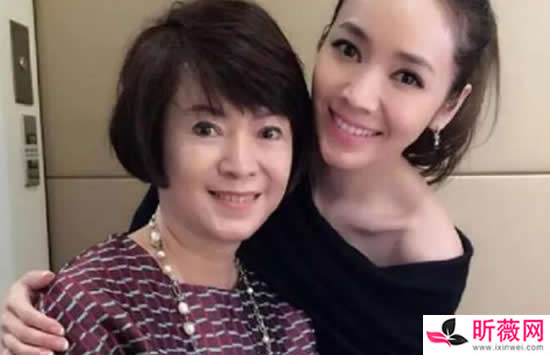 ���ܾ��������ϼ��� ���ܾ�����ô������