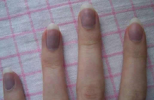 ָ�׷�����ʲôԭ��? ��ָ�׷���ͼƬ����