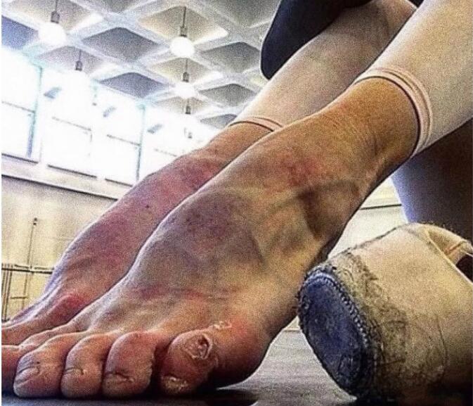 唐诗逸为什么脚是那样很难看 她身高没有166吧