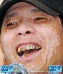 ��С�հװ߲����ں����� ��С�յ�������ʲô�����µ�