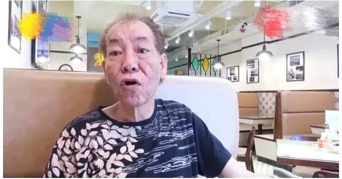 ��Ա���׻���״���˸ΰ�ûǮ�� ���׻�������Ǻڰ��Ա