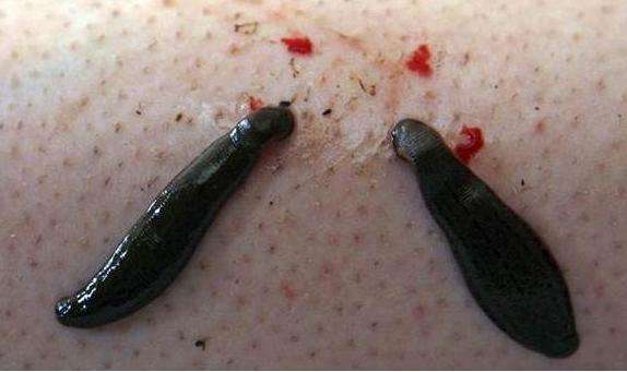 河蟹体内的蚂蟥怎么杀掉 如何去除河蚌体内蚂蟥等微生物