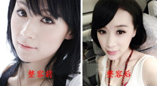 Ҧܷ������ǰ��Ա���Ƭ Ҧܷ��������