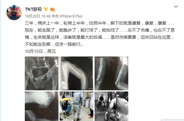 �������˺����� �����������������ʲô��