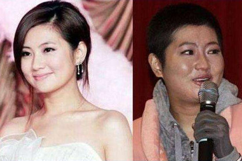 �ư������˺�ָ���Ƭ ������Ϊʲô���Ż�