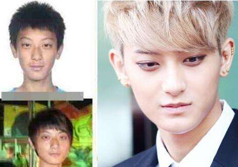 黄子韬素颜照前后对比图 黄子韬为什么退出exo是因为受伤