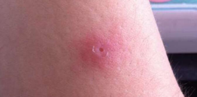 �������˺��˿�ͼƬ �������˴�û�λ�����