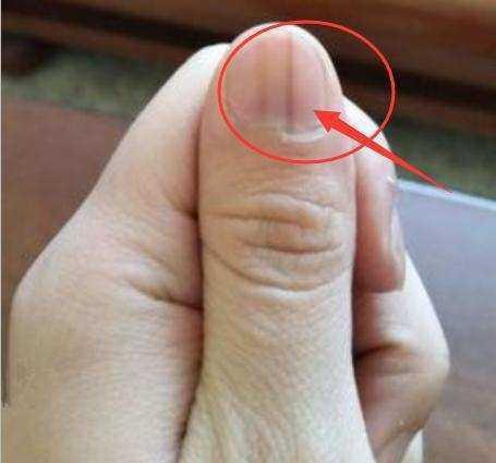 ����ָ�׺��ߴ�����֢ ���������еĺ��߶��ǰ�֢