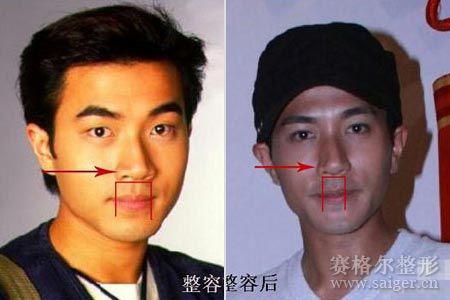 ����������ǰ��Ա���Ƭ ������˵������һ������5��