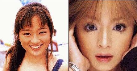 ���鲽���۽�����ǰ��Ա���Ƭ ���鲽��״���