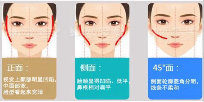 ����ȧ�Ǹ��ǿ˷��� �����ж��Լ�ȧ���ǲ��Ǹ�