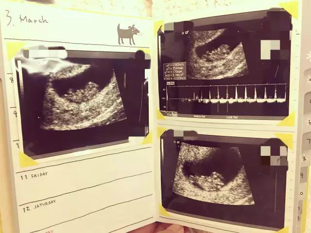 �º��ǳ¿������ֶ���� �ºյ��������������������ع�