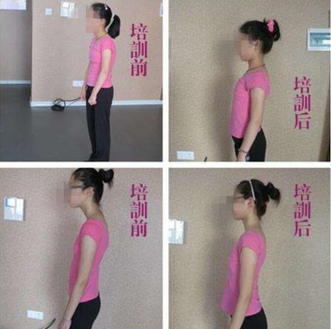 ����ǰ�����Ա���Ƭ 2���˿������ȷ����ͼ