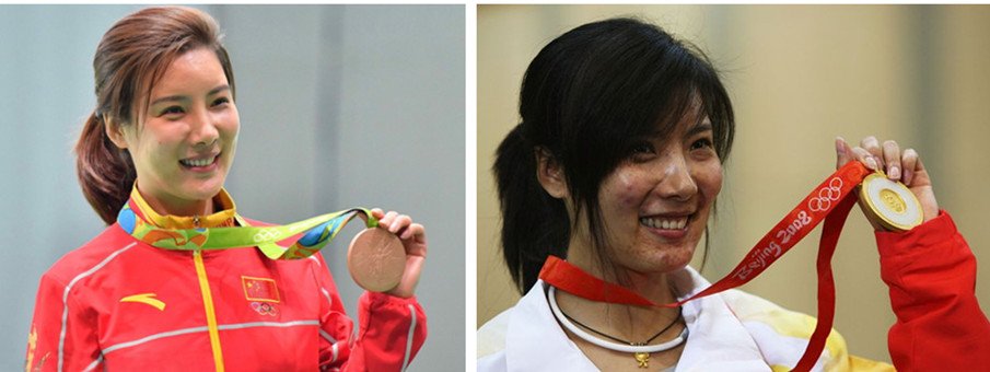 杜丽整容前后对比照 杜丽颁奖没戴胸罩照片