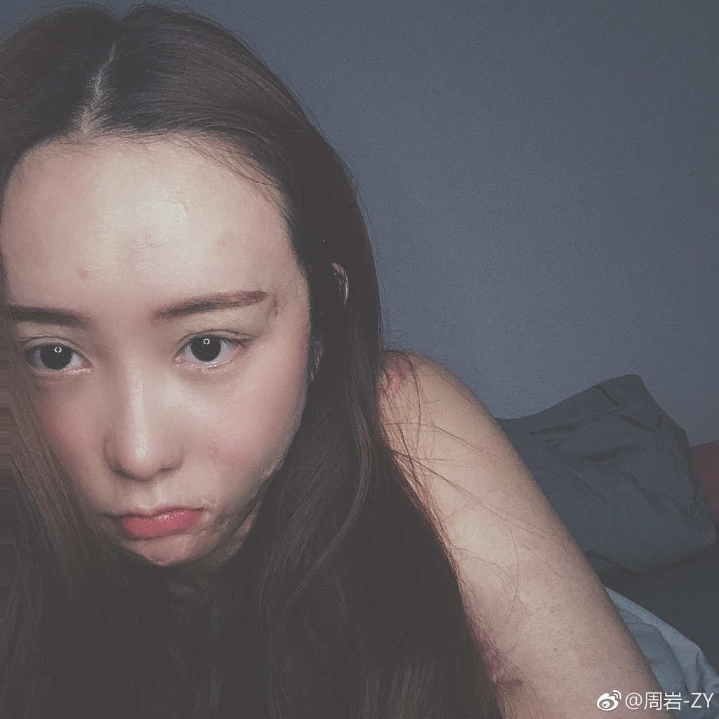 安徽毁容周岩事件回顾 周岩现状如何