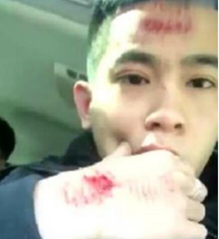 ������ϱ��� �ܶ�����ϲ���ƺ����������