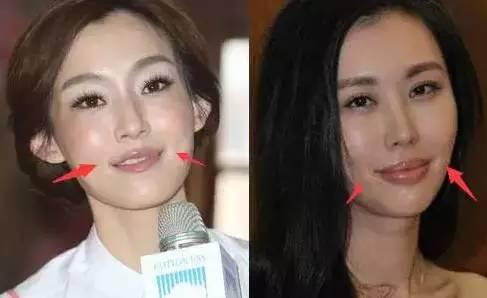 ΢�������Ժ������ ��ʵ��һ���ĺ���֢