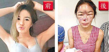 ΢�������Ժ������ ��ʵ��һ���ĺ���֢