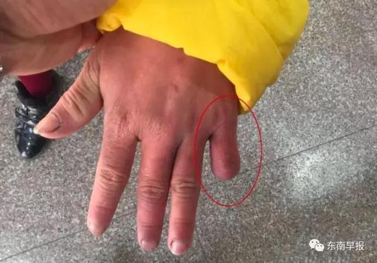 12��Ůͯ������ұ�����ͼƬ �ұ��Ժ�������Щ����Ӱ��