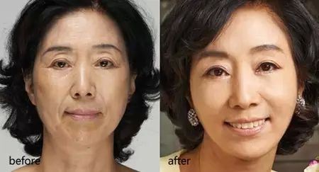 女性法令纹深面相图解 法令纹深代表什么