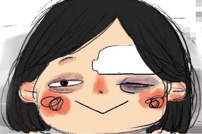 破相是什么意思 破相是好事还是坏事