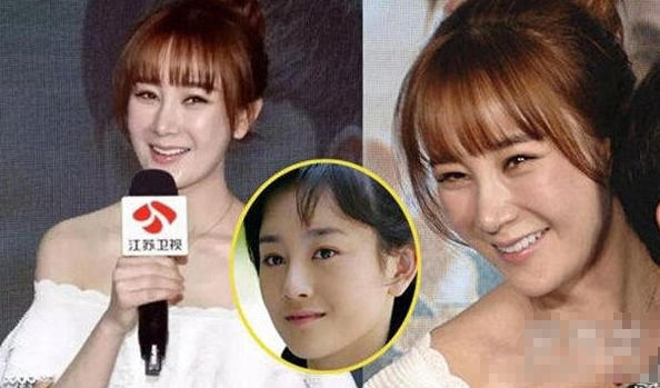 张檬整容前后对比照片 张檬取出假体后的照片曝光