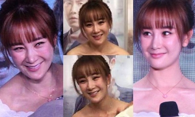 张檬整容前后对比照片 张檬取出假体后的照片曝光