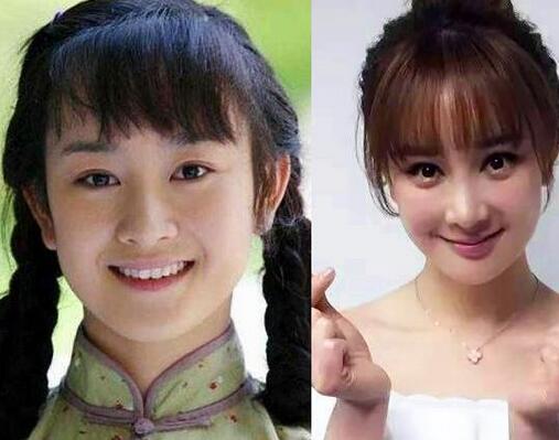 张檬整容前后对比照片 张檬取出假体后的照片曝光