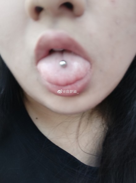 ��ͷ�ϴ���ʲô���� ��ͷ���и�����ʲô����