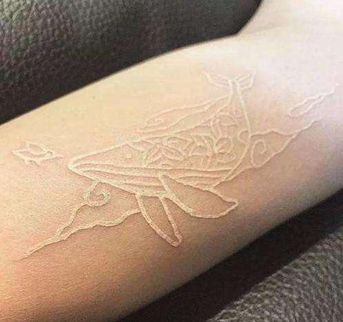 ����Ѫ�����Ⱦ�ǰ��ͼƬ ����Ѫ�����������ô